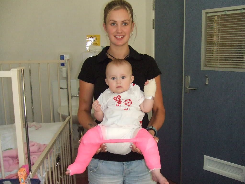 Hip kids/Hip Dysplasia Support Group Babies and Kids With