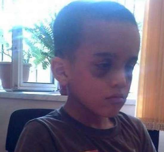 В Бакинском интернате 7 - летнего ребенка избили дубинкой (ФОТО ОБНОВЛЕНО)