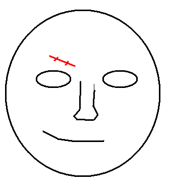 scar.png