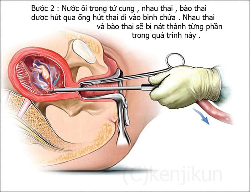 thainho2.jpg image by huukhanhch